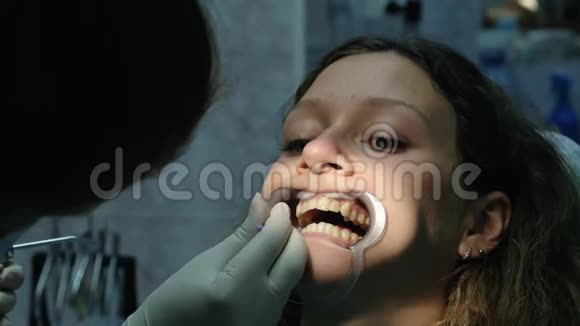 牙医在处理和安装支架系统特写之前将棉花放进嘴里给女孩视频的预览图