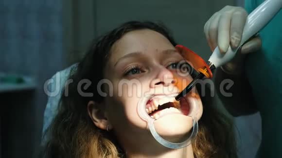 牙医助理用牙科聚合紫外线灯照射患者牙齿特写访问视频的预览图