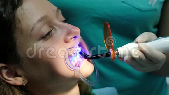 去看牙医口腔医生用牙科聚合紫外线灯照在牙套上给病人特写视频的预览图