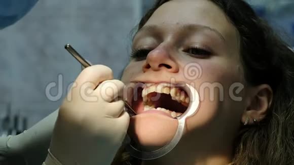 金属支架的安装与固定到牙齿矫正师牙科医生那里做牙齿矫正特写视频的预览图