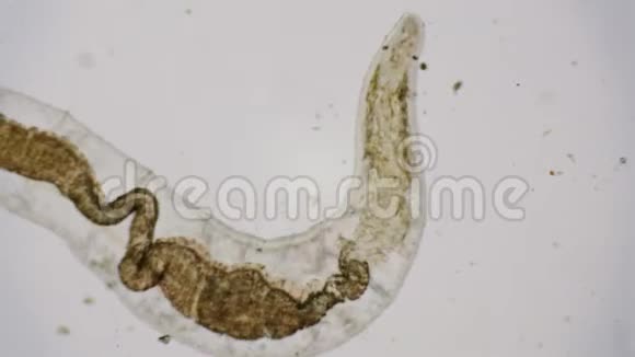 显微镜下的蛔虫在4k视频的预览图