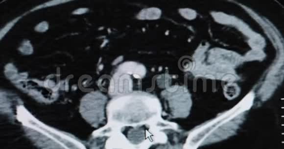核磁共振脑扫描磁共振图像视频的预览图