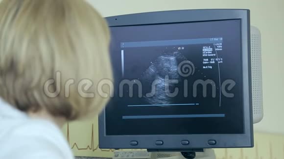 医生用超声波检查病人心脏病人的诊断和超声检查视频的预览图