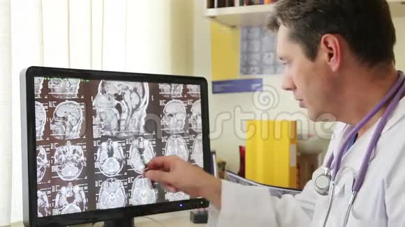 医生描述CT扫描视频的预览图