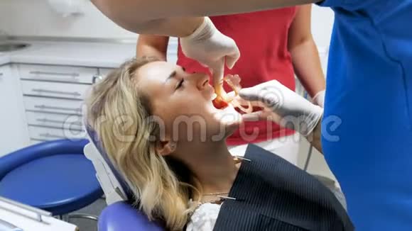 牙科医生在病人口中插入特殊的口宽器4k镜头视频的预览图
