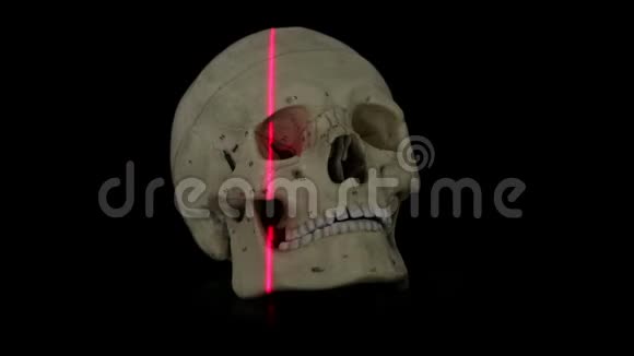 人颅骨模型激光线三维扫描视频的预览图