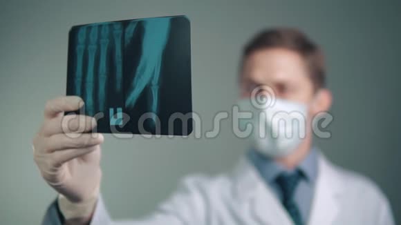 医生检查x射线图像视频的预览图