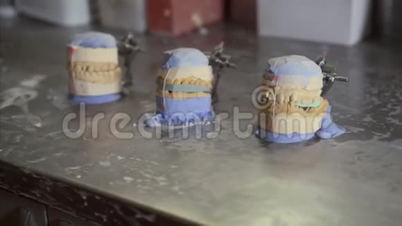 牙科诊所的人造牙齿视频的预览图