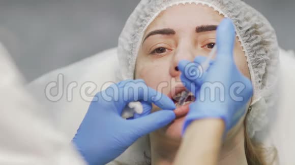医生用注射肉毒杆菌增加女性的嘴唇视频的预览图