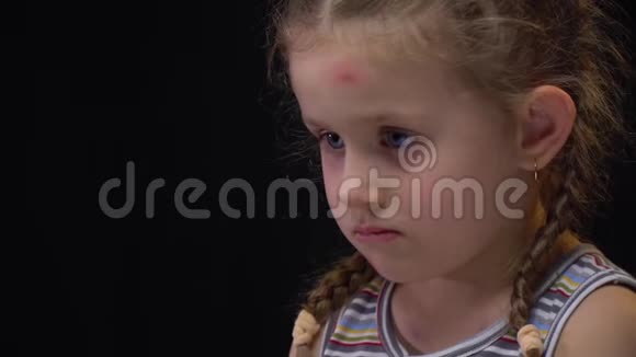 伤心的孩子脸上有伤痕社会问题视频的预览图