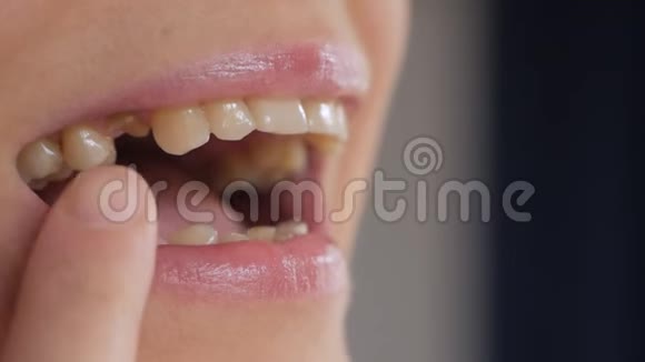 一位成年女性在检查她嘴里缺失的牙齿时的面部特写视频的预览图