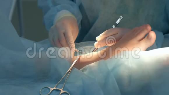 外科医生用可吸收的线缝合腿部脚踝视频的预览图