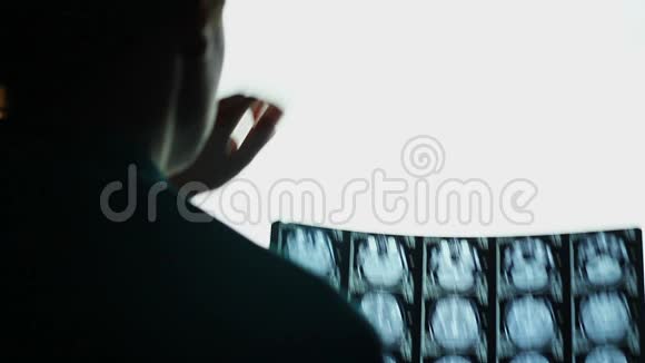头颅MRI外科医生观察头骨脑X线片分析视频的预览图