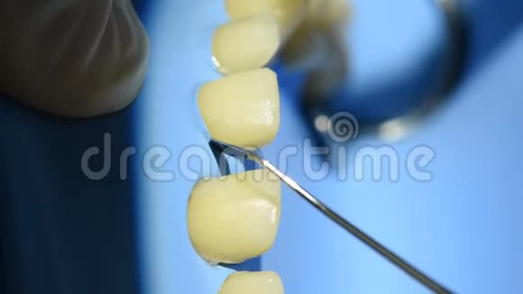 牙科手术室牙齿的特写镜头视频的预览图