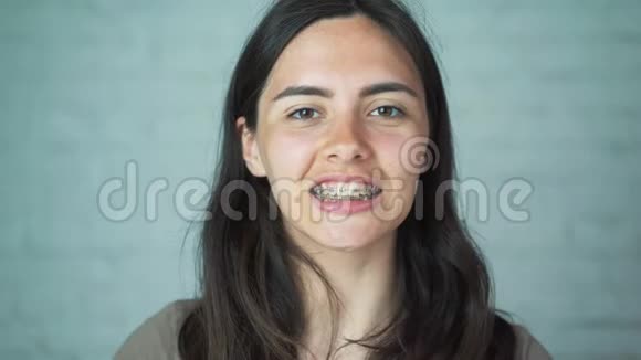 咬在牙齿上女孩微笑着在牙齿上露出牙套洁白健康的牙齿视频的预览图