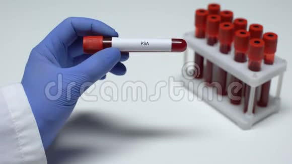 PSA检测医生在试管中显示血样实验室研究健康检查视频的预览图