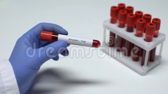 淀粉酶测试医生在试管中显示血样实验室研究健康检查视频的预览图