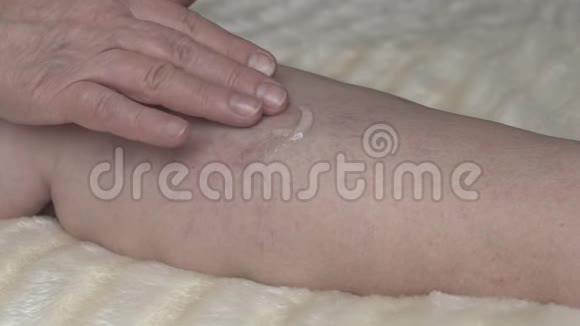 女人在腿部静脉曲张上涂上一层愈合霜特写慢动作药膏视频的预览图