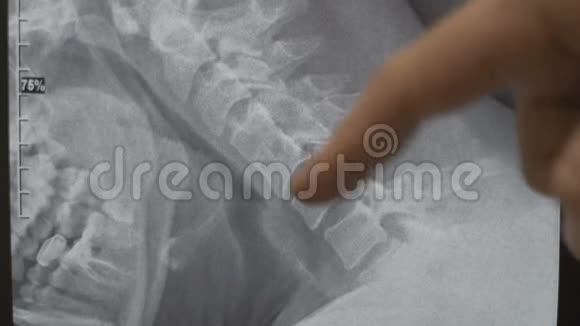 专业脊柱专家查看核磁共振扫描检查恢复进度视频的预览图