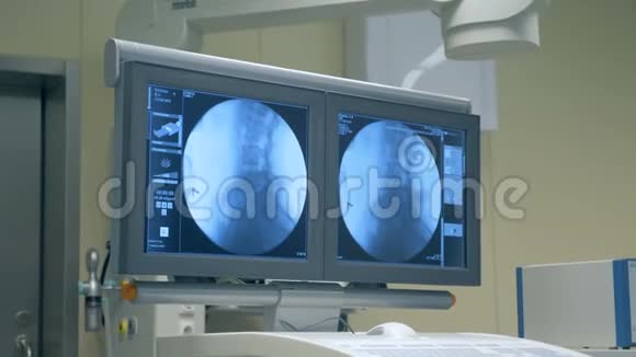 医学屏幕上脊柱和骨盆的图像4K视频的预览图