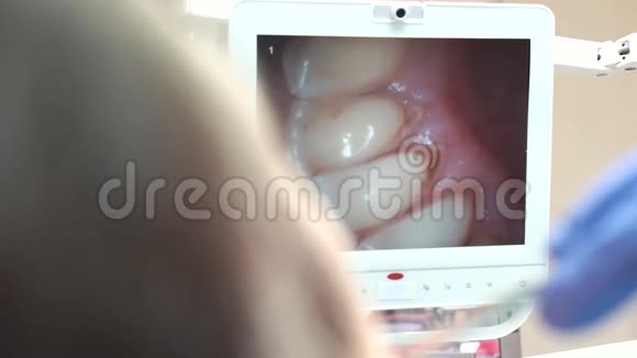 口腔内摄像机监视器视频的预览图