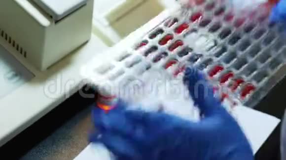 护士把血样放在医疗盘里视频的预览图