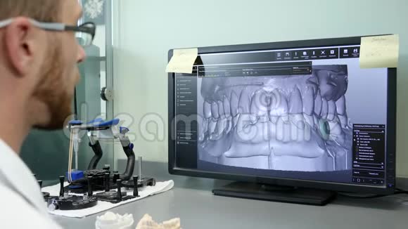 数字牙齿建模男性进入3D眼镜前面的电脑显示器和看颌骨视频视频的预览图