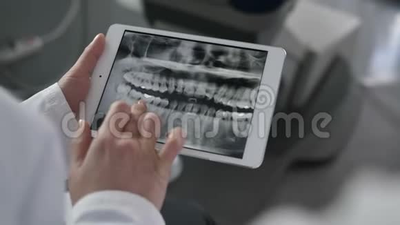 在平板电脑上看x光的牙医视频的预览图
