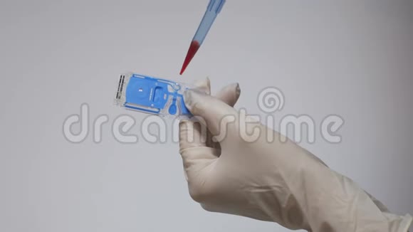 血样的概念医生进行生化血液测试测量血液中的葡萄糖水平这就是视频的预览图