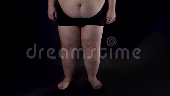 深色背景下的肥胖男性腿部健康问题不安全感疾病视频的预览图