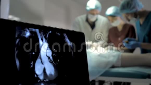 手术室病人心电图及饱和O2监测视频的预览图