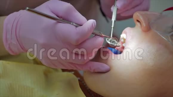 妇女牙科对门诊病人的牙齿治疗工作中的女性专业口腔医生概念视频的预览图