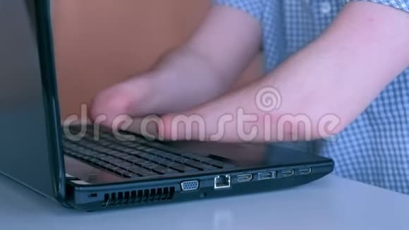 被截肢的残疾人双手在笔记本电脑上打字特写镜头视频的预览图