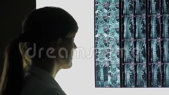 罕见脊椎损伤病例医生看病人的x光片作出诊断视频的预览图