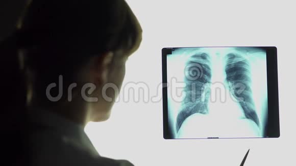 肺炎治疗师分析肺部x线图像得出结论医疗保健视频的预览图