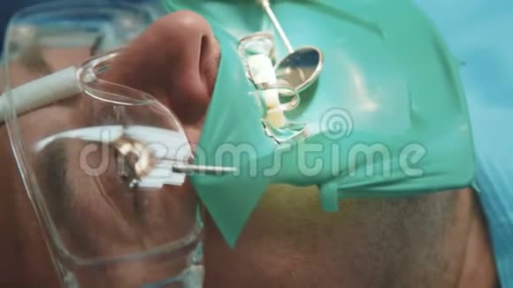 牙科医生用围堰治疗病人4K视频的预览图