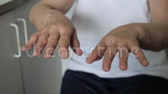 颤抖的双手在颤抖的老女人的皱纹中的特写视频的预览图