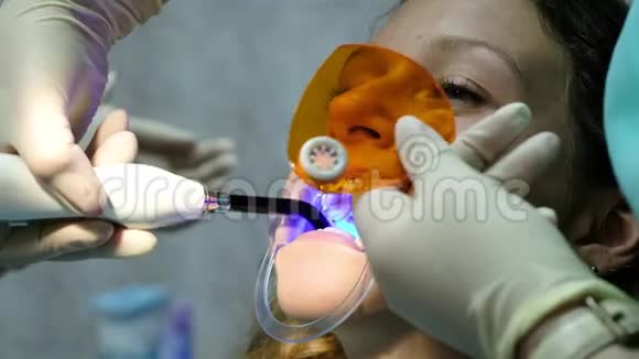 助理用牙科聚合紫外线灯照射固定支架特写去看牙医视频的预览图