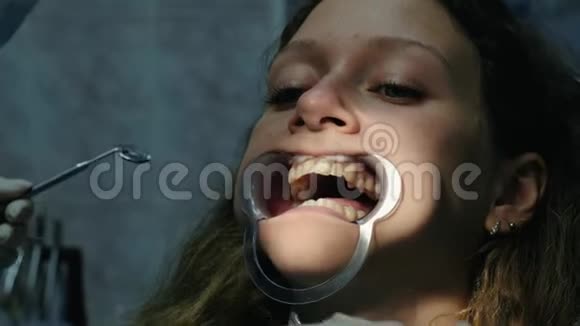 金属支架的安装与固定去看牙医矫正牙合畸形视频的预览图