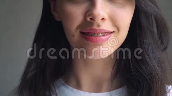 用牙槽和牙间刷封闭女性牙齿以保持牙齿卫生正畸治疗正面观点视频的预览图