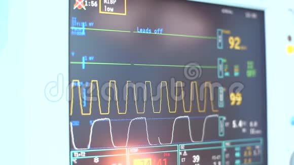数字心脏监测器读出接近线图形和数字显示的病人被测量数字视频的预览图