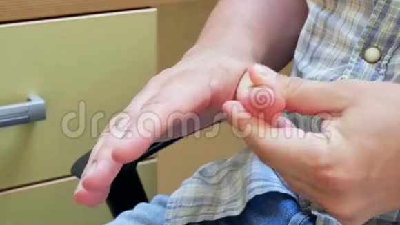 使用电脑办公综合征引起的手部疼痛视频的预览图