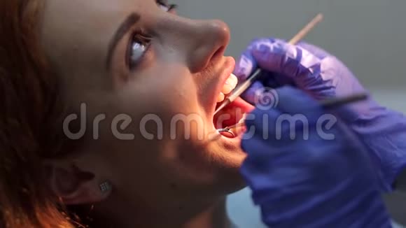 牙科医生给一个年轻女孩治牙视频的预览图
