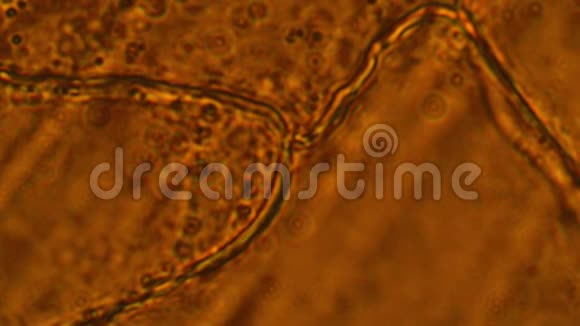 大蒜细胞在显微镜下视频的预览图