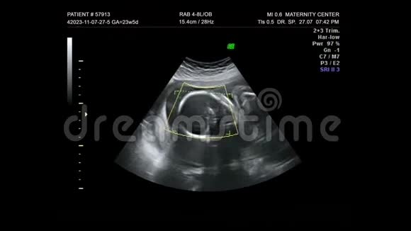 幼母孕婴儿胚胎超声3D4D视频的预览图