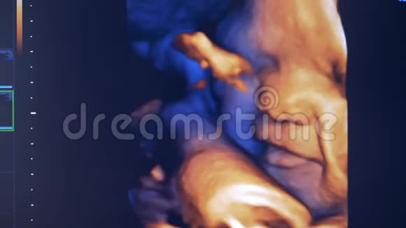 超声监视器上胎儿的实时图像胎儿在子宫里的真实形象视频的预览图