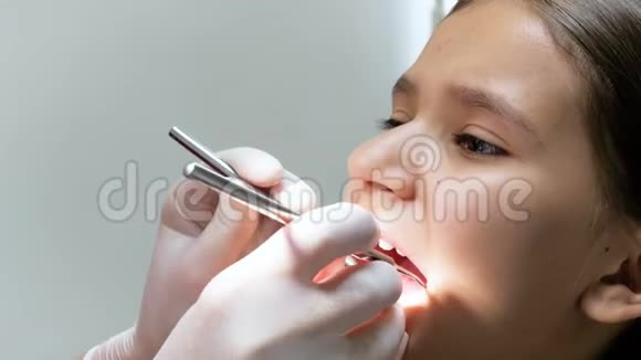 牙科医生用特殊工具检查病人牙齿的4k镜头视频的预览图