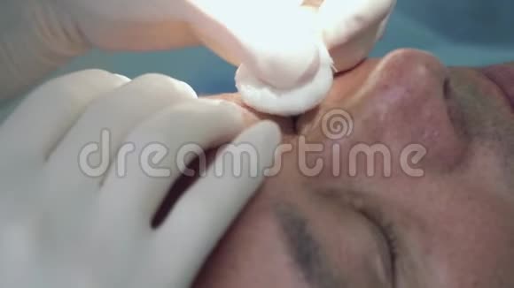 医生在手术前消毒病人的皮肤视频的预览图