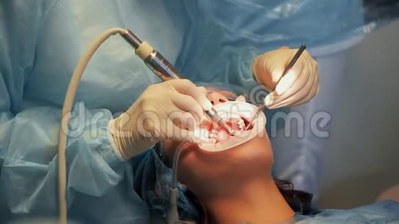 医生牙医给女病人做牙齿美白视频的预览图