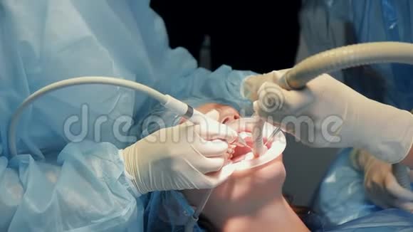 牙科医生和助理进行牙齿美白手术视频的预览图